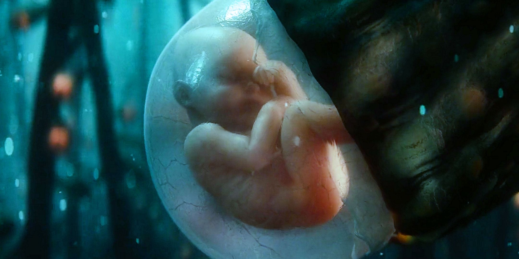 Zack Snyder's Biggest Man of Steel Problem Is Not the One Fans Think