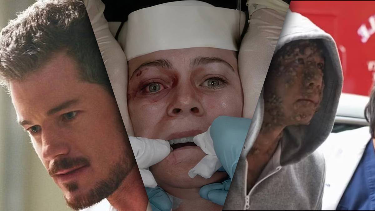 10 Grey's Anatomy Moments Too Disturbing to Watch More Than Once