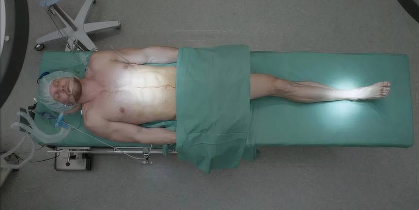 Carson on the operating table with a leg reattached to the center of his body